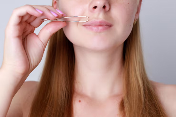Hirsutism